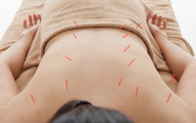 Enhance Your Practice with Texas Acupuncture Continuing Education