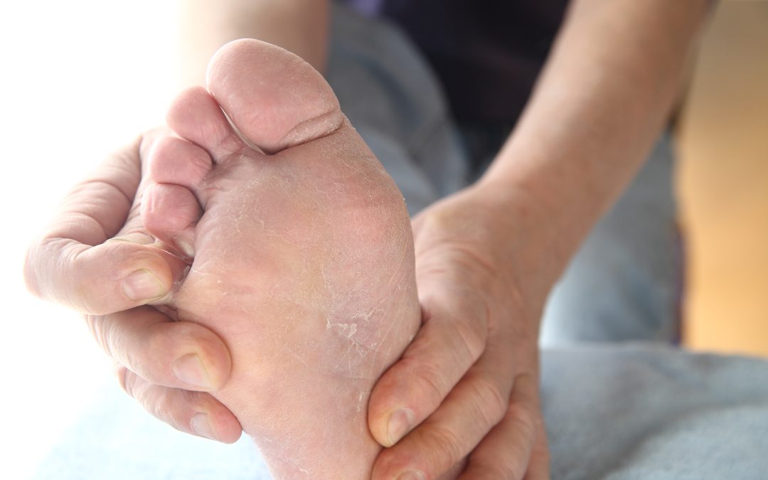 Relief from Pain with Ingrown Toenail Treatment in Haymarket, VA by Local Experts