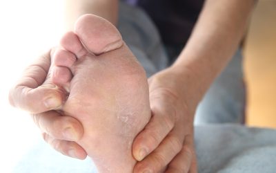 Relief from Pain with Ingrown Toenail Treatment in Haymarket, VA by Local Experts