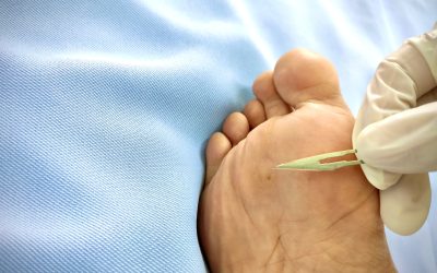 Choosing the Right Podiatrist in Cypress, TX for Lasting Foot Health Solutions